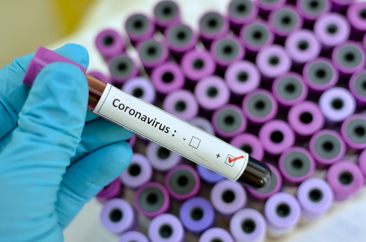 This image shows a blood sample that was positive for coronavirus. Over 400 have died from this disease in China and the number continues to rise.